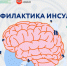 В Минздраве Якутии напомнили о способах профилактики инфаркта и инсульта - Правительство Республики Саха (Якутия)